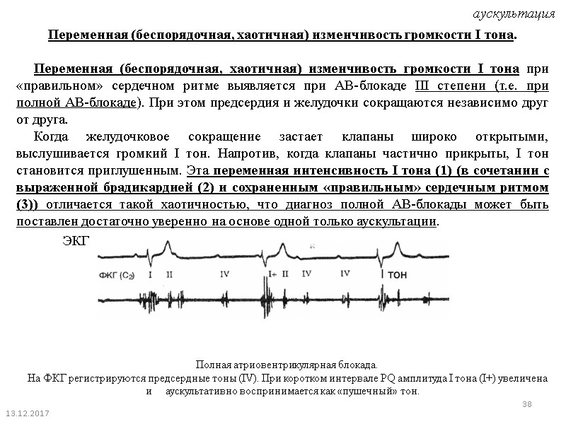 13.12.2017 38 Переменная (беспорядочная, хаотичная) изменчивость громкости I тона.     